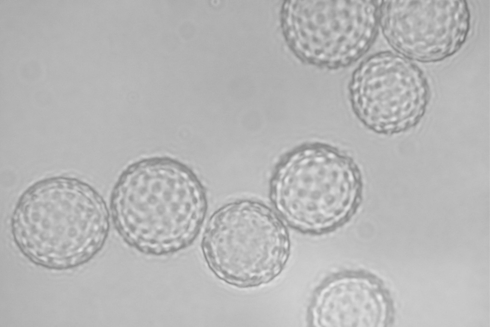 ambrosia meccanismo immunologico ambrosia meccanismo immunologico