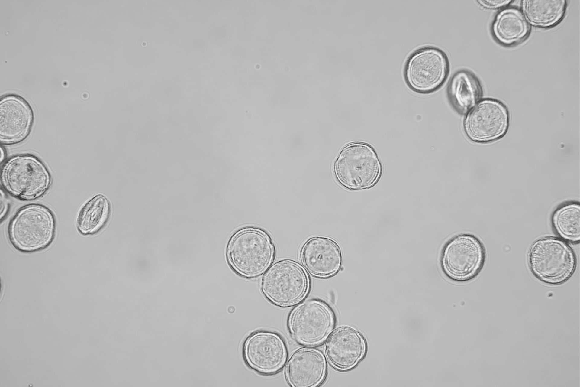 artemisa sensibilizzazione