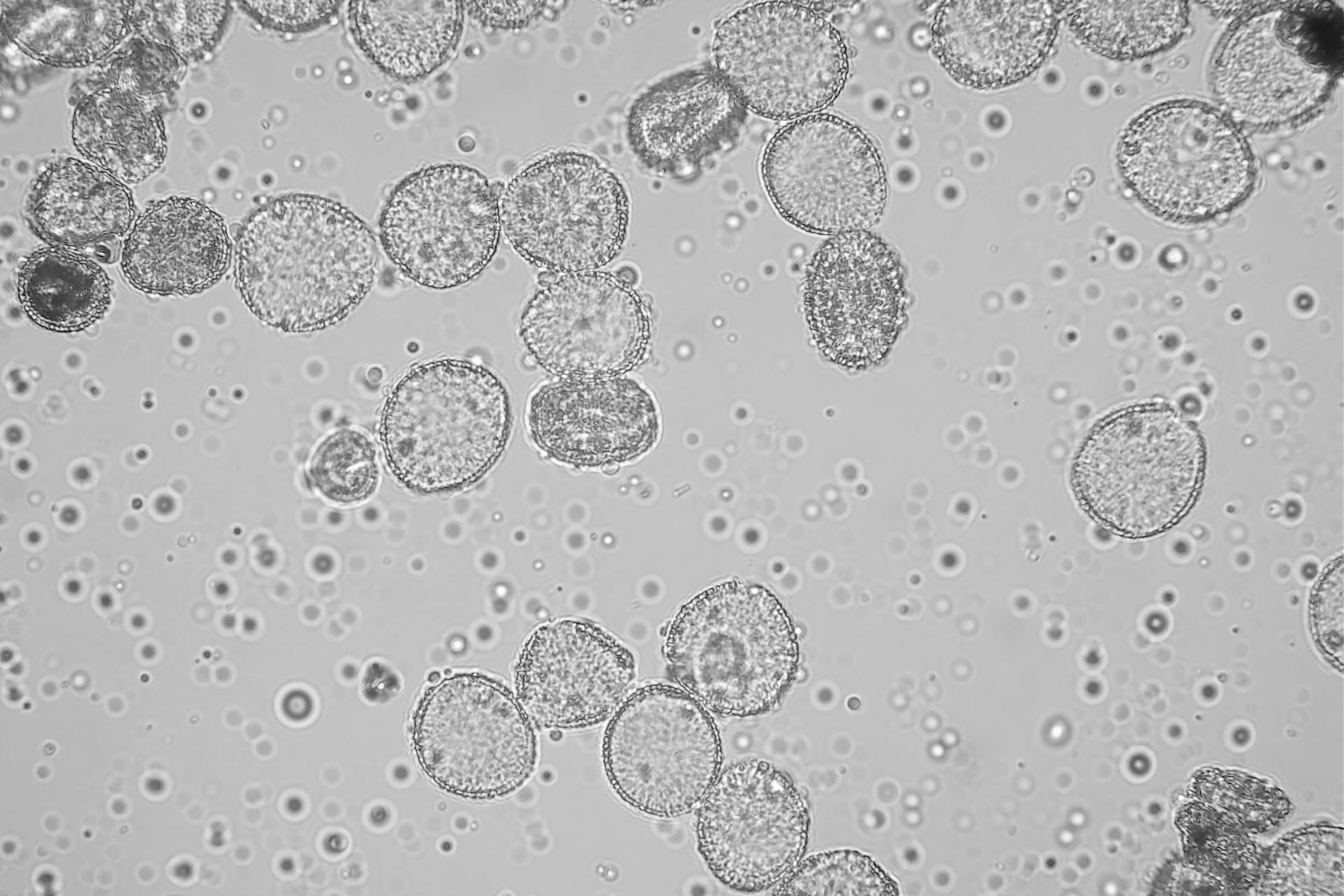Olivo sensibilizzazione Olivo sensibilizzazione