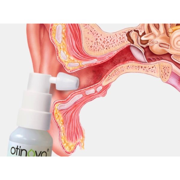 otinova2