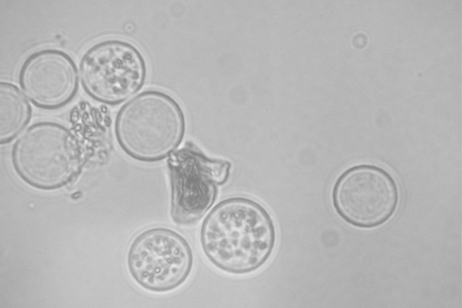 Parietaria monosensibilizzazione Parietaria monosensibilizzazione