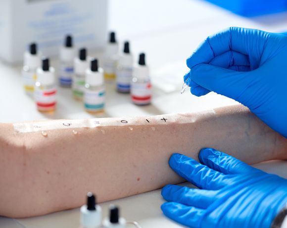 Prick Test 580 Prick Test 580
